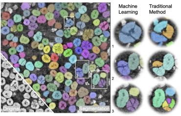 A new computer vision algorithm can better identify particles in an X-ray tomography image of a nickel-manganese-cobalt cathode. Older methods would mistake a single fractured particle for several different particles, while the new method can tell the difference. 